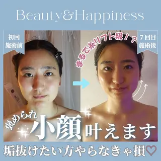 痩身ハーブピーリング 筋膜リリース☆B&Hのエステ・リラクイメージ