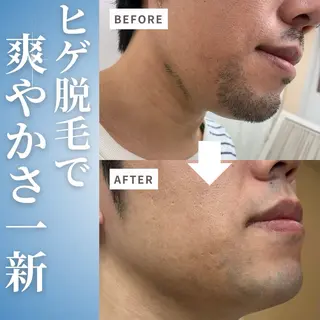 メンズ キッズ men's blanclis所属・メンズブランリス メンズ脱毛のエステ・リラクイメージ