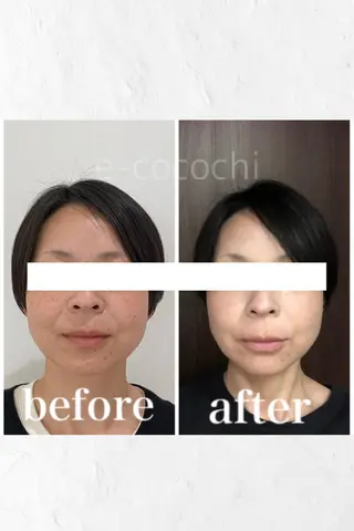 小顔と ヘッドスパのお店のエステ・リラクイメージ