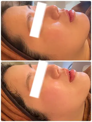 FLEUR大阪・整体 ・ハイフ・痩身・小顔のエステ・リラクイメージ