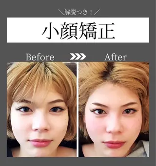 恵比寿/小顔/矯正 美容整体師⭐︎Aiのエステ・リラクイメージ
