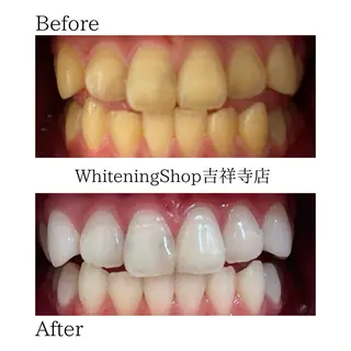 ホワイトニング ショップ吉祥寺店のエステ・リラクイメージ