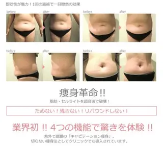 アイアンド ネイルデイのエステ・リラクイメージ