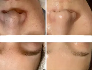 小顔&デコルテ Spa　“koti”のエステ・リラクイメージ