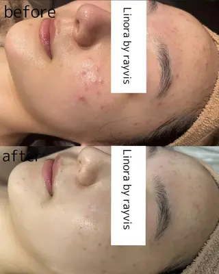 👑Linolaby RAYVIS👑⭐️のエステ・リラクイメージ