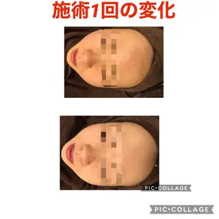 ミディアム カラー パーマ ヘアアレンジ メンズ キッズ ネイル マツエク・マツパ アイブロウ アニメ,Vオタク× 即効痩せエステサロンのエステ・リラクイメージ