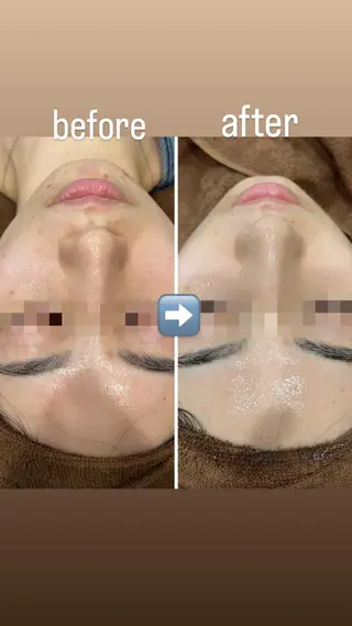 ミディアム カラー パーマ ヘアアレンジ メンズ キッズ ネイル マツエク・マツパ アイブロウ Amaryllis 🌹松本のエステ・リラクイメージ