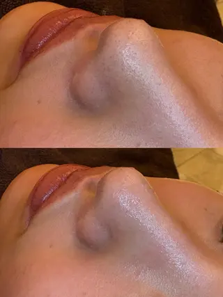 EARTH coiffure beaute 新潟紫竹山店所属・🤍アベシュリ /フェイシャル🤍のエステ・リラクイメージ