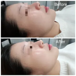 肌質改善Beauty salon Renのエステ・リラクイメージ