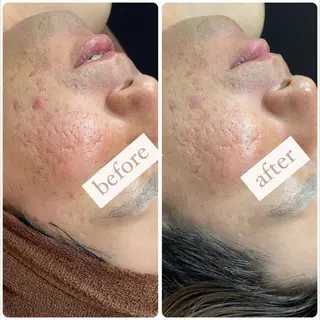 立体小顔×艶肌×美ボ ディ似合わせ施術 岡のエステ・リラクイメージ