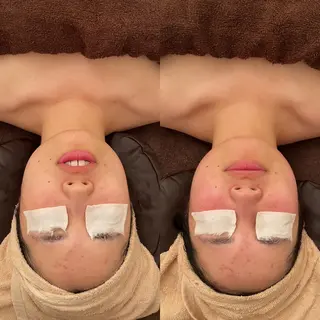 毛穴ケア/毛穴診断/ 毛穴洗浄〔心斎橋〕のエステ・リラクイメージ