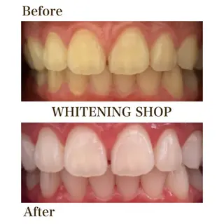 メンズ ホワイトニング ショップ川越店のエステ・リラクイメージ