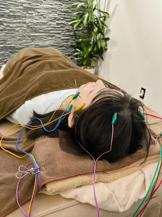 美容鍼灸整体サロンBeauJu所属・小顔矯/美容鍼/鍼灸 BeauJuのその他イメージ