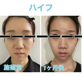 本格エステの ヘッドスパのその他イメージ