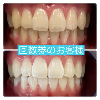 PLATINUM Beauty 横浜店所属・ホワイトニングルーム 横浜店のその他イメージ