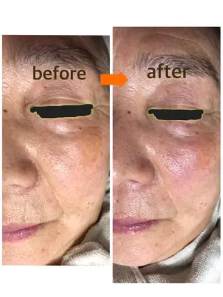 小顔・毛穴・たるみ ネイル　似内真樹のエステ・リラクイメージ