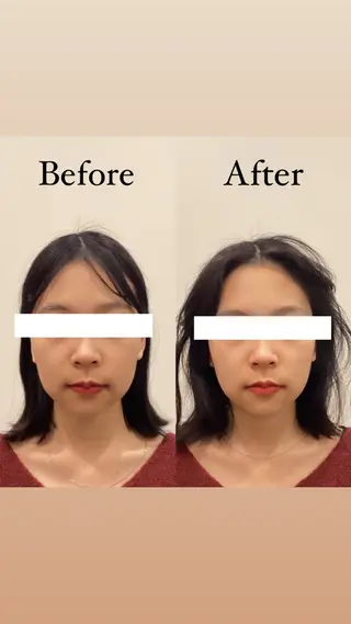 Hari Lounge恵比寿所属・chika🦋 ハリラウンジ恵比寿のエステ・リラクイメージ