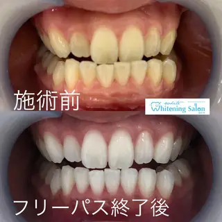 ホワイトニング&アイラッシュ四日市ホワイト所属・アイラッシュ ホワイトニング四日市のマツエク・マツパデザイン