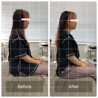 メディカルサロンドオフ所属・ハリサロンドオフ 美容鍼灸×小顔整体のエステ・リラクイメージ