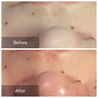 産毛専門店 Bittoのエステ・リラクイメージ