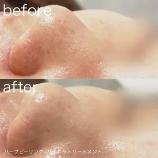 lulularico Yu🫧のエステ・リラクイメージ