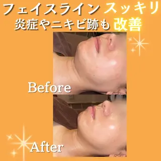 🫧ビュースタ 伊藤🫧のエステ・リラクイメージ