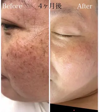 千葉バストアップサロン LUNA所属・バストアップサロン LUNAのネイルデザイン