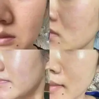 マツエク・マツパ aliaハイフ&水光ジェットサロン所属・aliaハーブ水光店 エステティシャン募集のエステ・リラクイメージ