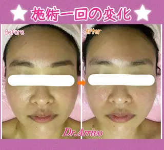 セミロング カラー パーマ ヘアアレンジ メンズ キッズ ネイル マツエク・マツパ 痩身&ボディ 結果出し🌟丹野のエステ・リラクイメージ