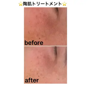 アロマ,陶肌 SalonYokoのエステ・リラクイメージ