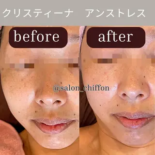 肌質改善エステ chiffonのエステ・リラクイメージ