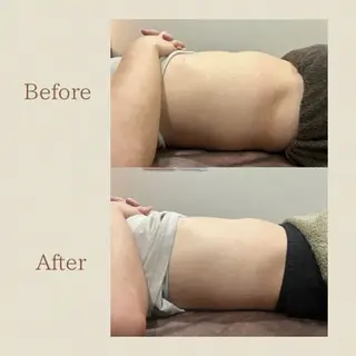 お腹痩せエステ Flat BELLY 恵比寿所属・【腸もみ/脂肪冷却】 お腹エステ/恵比寿のエステ・リラクイメージ
