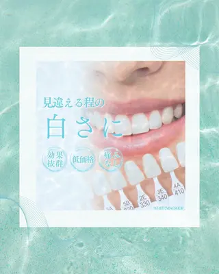 ホワイトニングショップ静岡葵区店所属・ホワイトニング ショップ静岡葵区店のその他イメージ