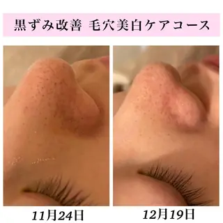 Bellesthe (ベルエステ)のエステ・リラクイメージ