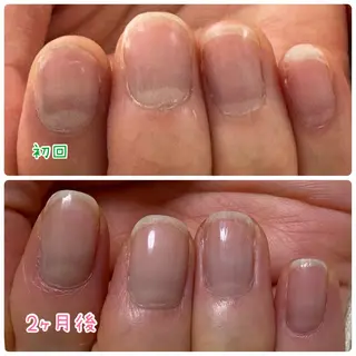ネイル Ella nailsalon所属・Ella nail ちゆうのネイルデザイン