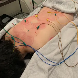 新宿hari-me所属・美容鍼hari-me 新宿のエステ・リラクイメージ