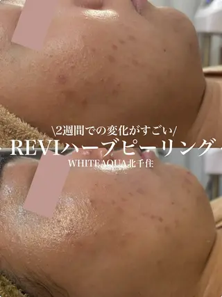 WHITE AQUA 北千住店のエステ・リラクイメージ