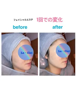 フェイシャルエステLe・Ciel所属・Le・Ciel フェイシャル&ボディのエステ・リラクイメージ