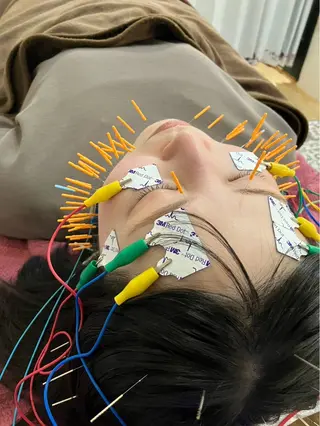 美容鍼灸女性専用 りんご鍼灸治療院のその他イメージ