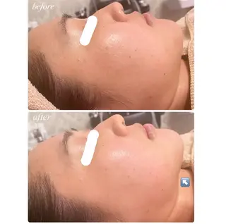 La Colzaのネイルデザイン