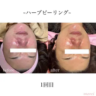 salon merci和泉のエステ・リラクイメージ