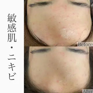 ハーブピーリング専門 BIOEL横浜のエステ・リラクイメージ