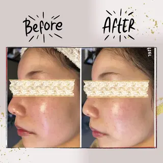 ピーリング専門店 Belluteのエステ・リラクイメージ