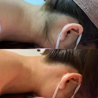 透明感の肌Lino malieのエステ・リラクイメージ