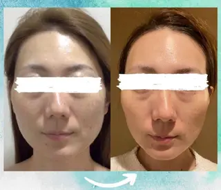 エステ♡ Eden Yuriのエステ・リラクイメージ