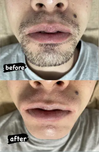 メンズ Epina 千葉店 【エピナ】のエステ・リラクイメージ