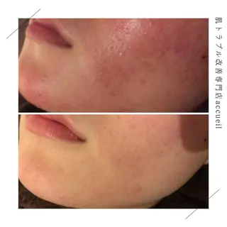 セミロング カラー パーマ ヘアアレンジ メンズ キッズ ネイル マツエク・マツパ アイブロウ 触れたくなる モテ肌へ...❤︎のエステ・リラクイメージ