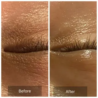 Mandarin Orange所属・毛穴から始める肌メン テマンダリンオレンジのエステ・リラクイメージ