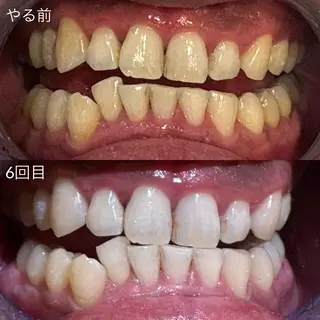 メンズ キッズ ホワイトニングサロン Ecru所属・ホワイトニングサロン Ecru エクリュのその他イメージ