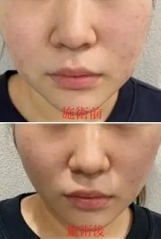 美容術前術後ケア＆ 予防美容ツインズのエステ・リラクイメージ